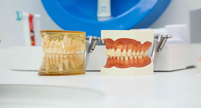 Prophylaxe Zahnarztpraxis Strasen